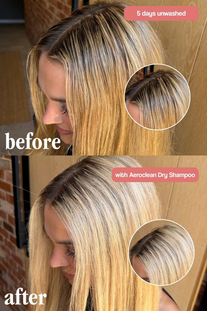 Aeroclean Dry Shampoo with Hair Growth Complex - sausas plaukų šampūnas