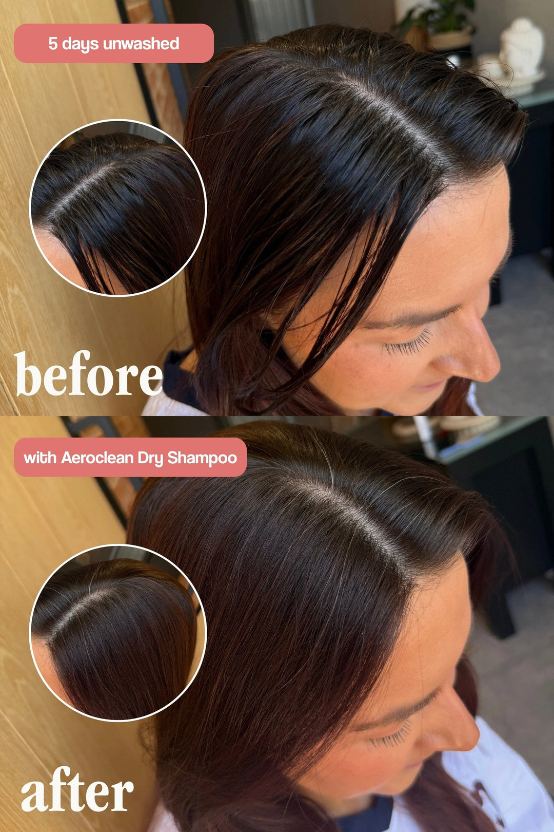 Aeroclean Dry Shampoo with Hair Growth Complex - sausas plaukų šampūnas