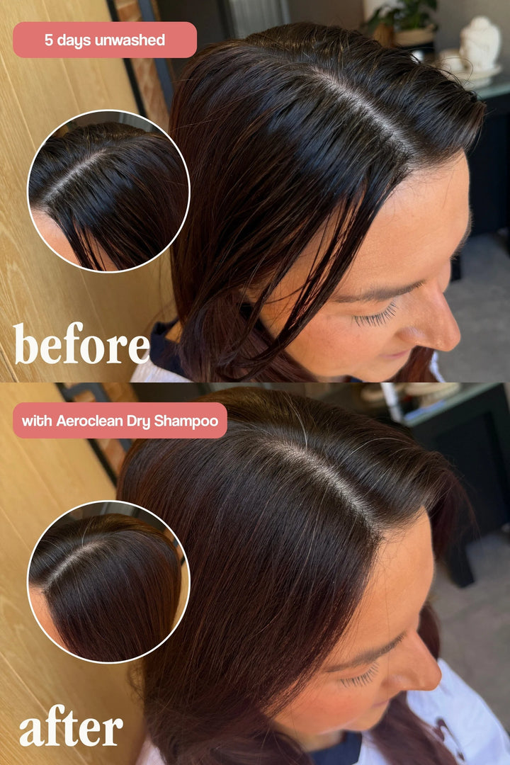 Aeroclean Dry Shampoo with Hair Growth Complex - sausas plaukų šampūnas